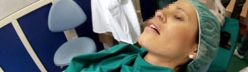 Una paziente di chirurgia orale sotto sedazione con ipnosi.